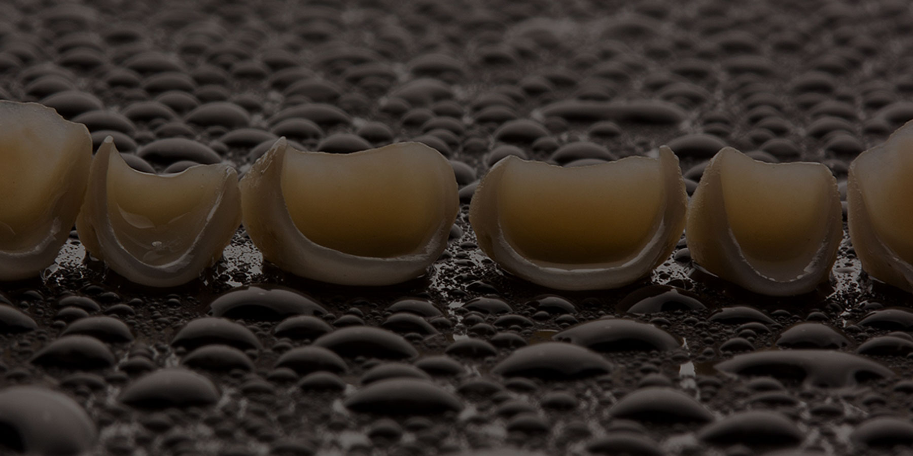 Slider Tratamientos